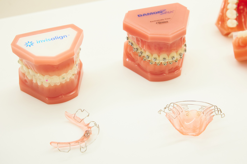 インビザラインだけでなくワイヤー矯正(舌側矯正)どちらもお選びいただけます