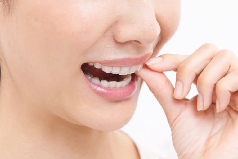 治療終了、保定期間